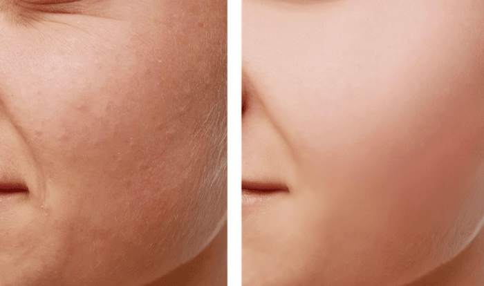 Saint' Skin Vitamin C Serum
