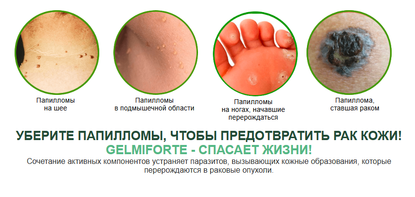 Gelmiforte